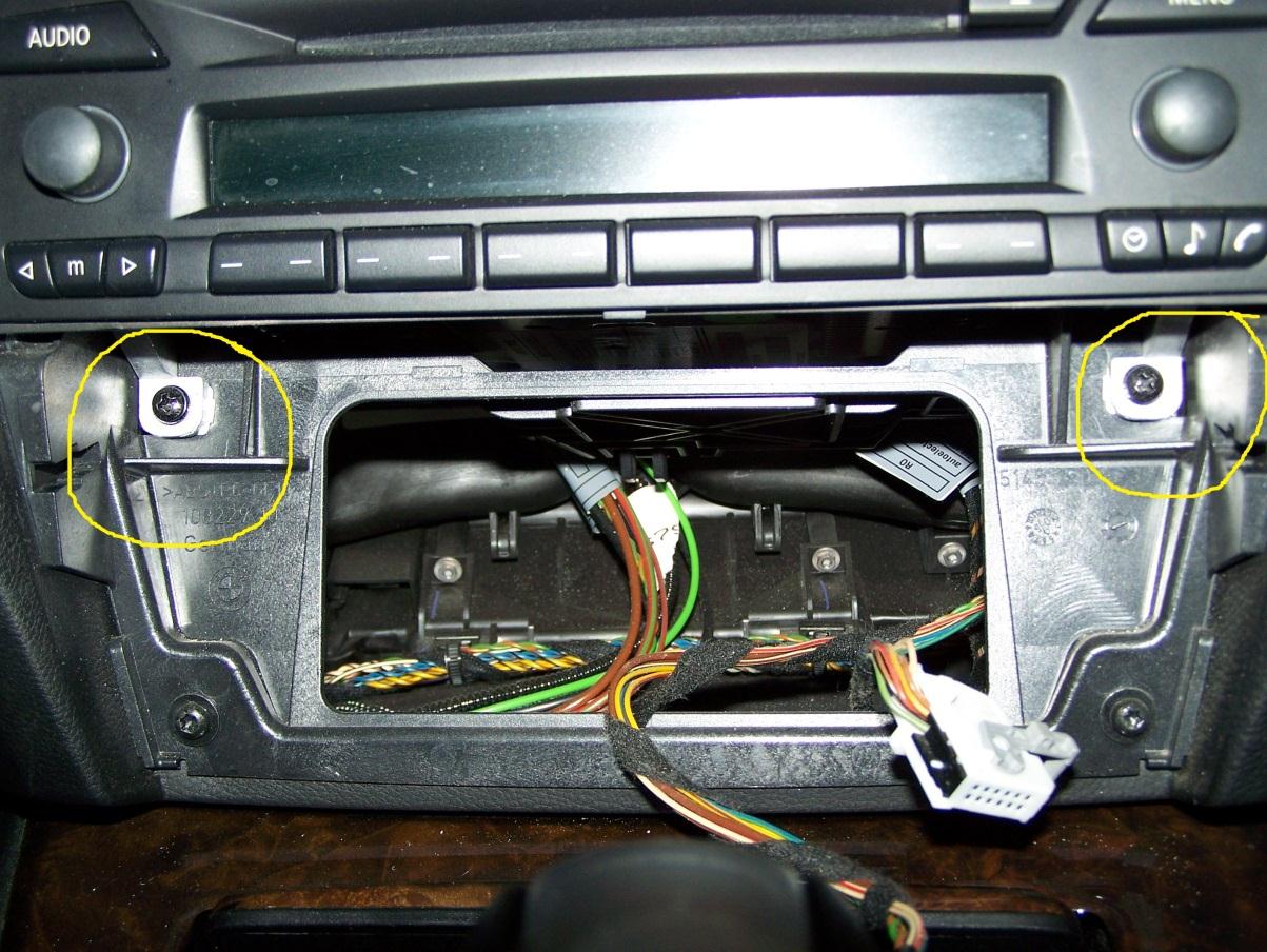 Remove radio